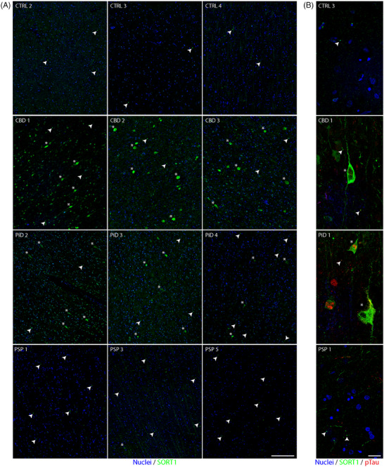 PMC12183113 – alz70401-fig-0007