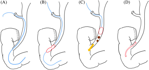 PMC8048915 – ases12845-fig-0003