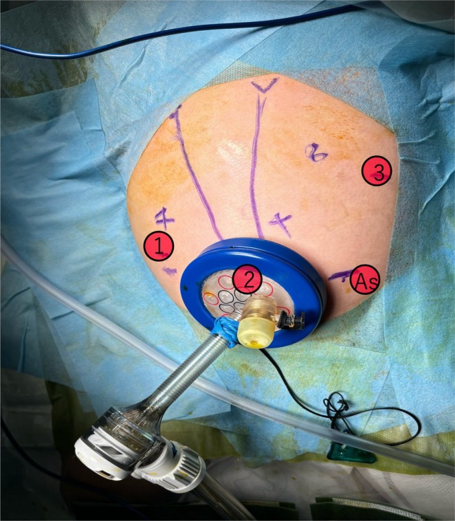 PMC12283185 – ases70122-fig-0002