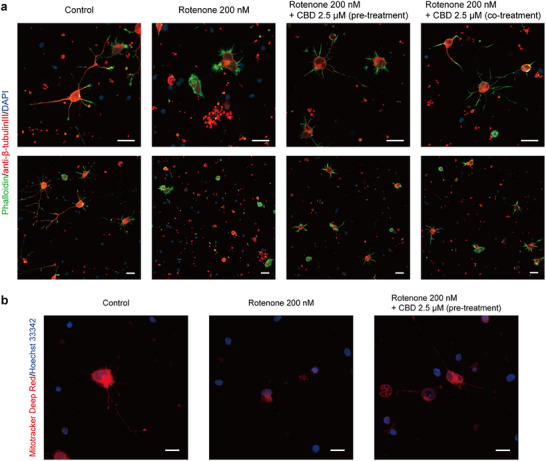 PMC12711387 – asia70441-fig-0003