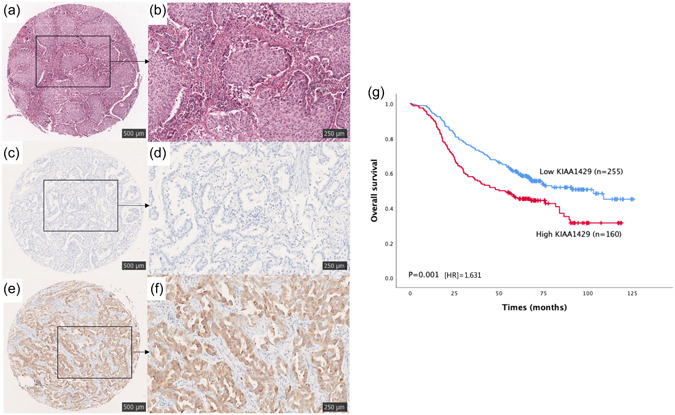 PMC10686173 – cai240-fig-0003