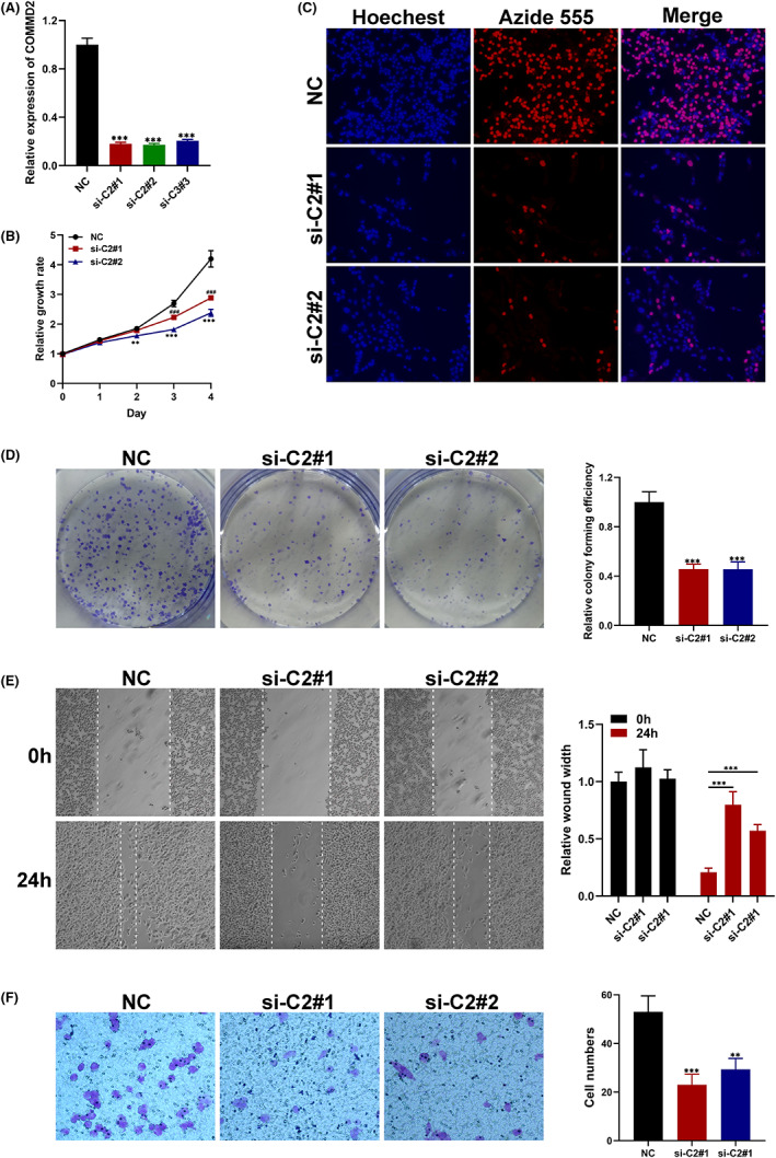 PMC10242316 – cam45320-fig-0011