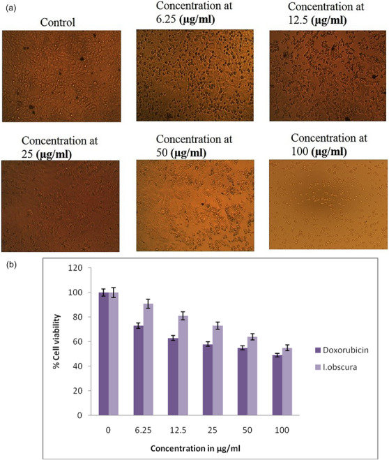 PMC12715991 – cbdv70376-fig-0001