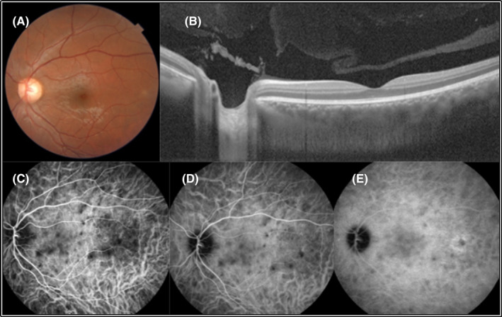 PMC10477722 – ccr37879-fig-0002