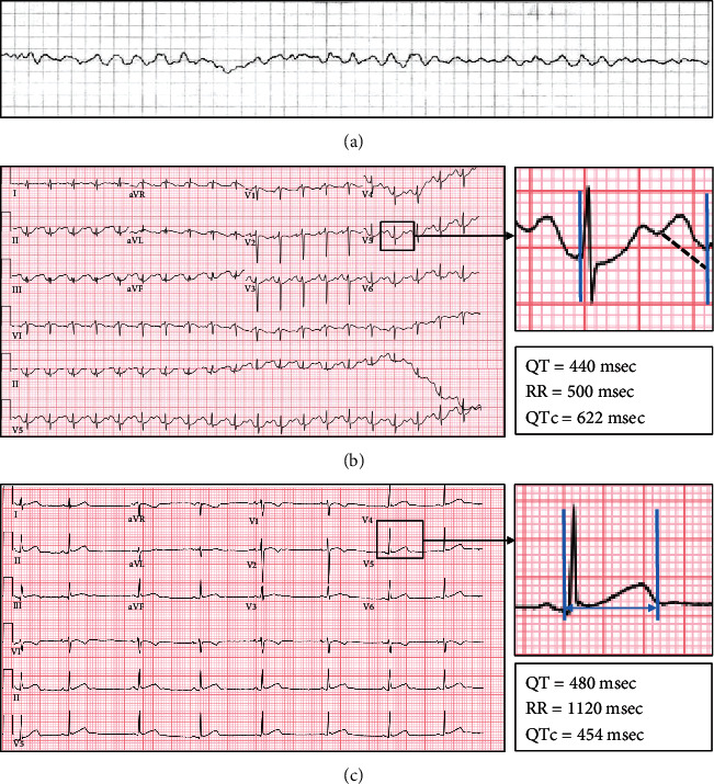 PMC8292089 – fig1