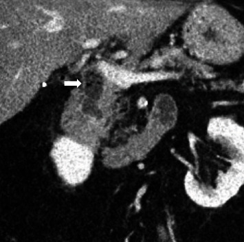 PMC11300095 – fig1