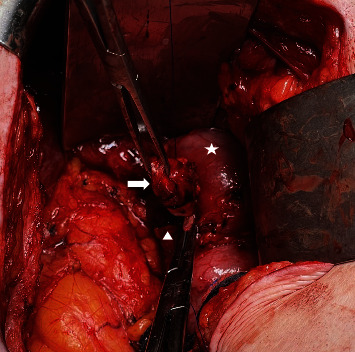 PMC11300095 – fig4