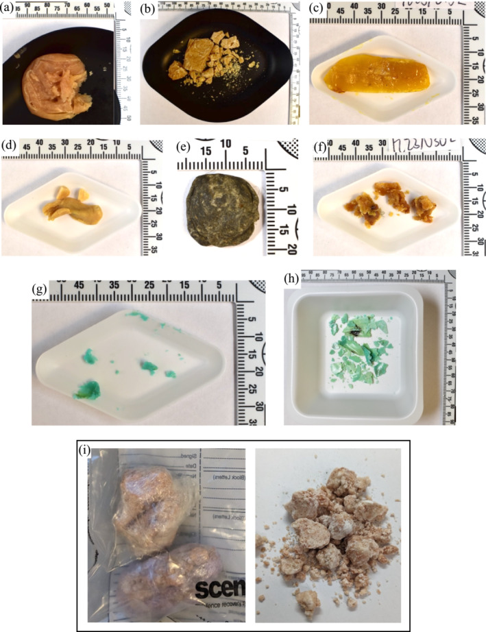 PMC12209699 – dta3817-fig-0002