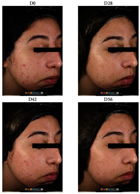 PMC10125735 – fig4