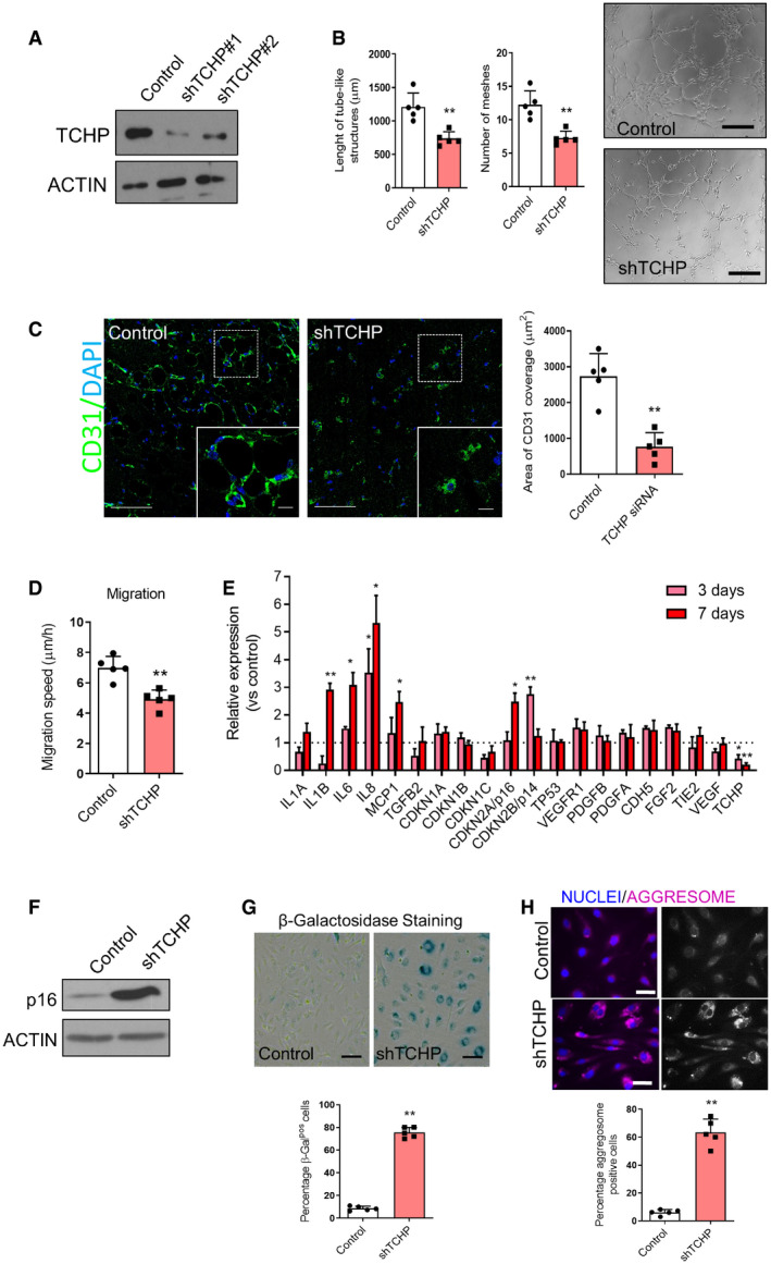 PMC7332983 – embr201948192-fig-0001ev