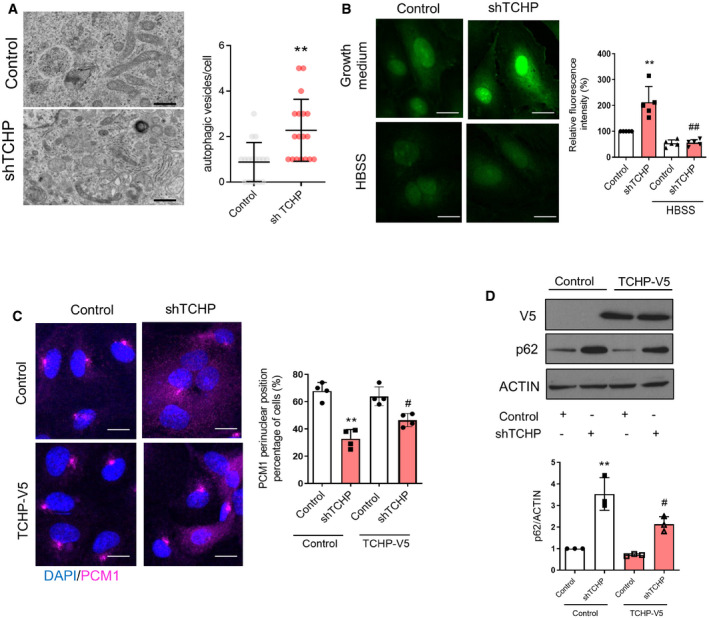 PMC7332983 – embr201948192-fig-0002ev