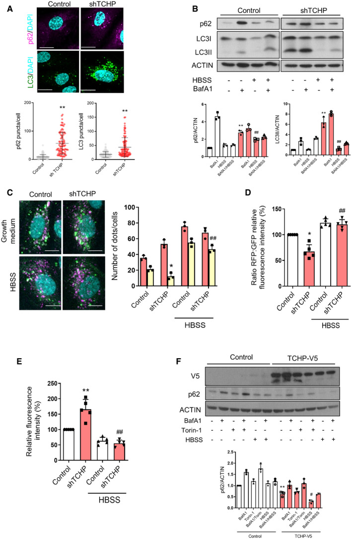 PMC7332983 – embr201948192-fig-0003