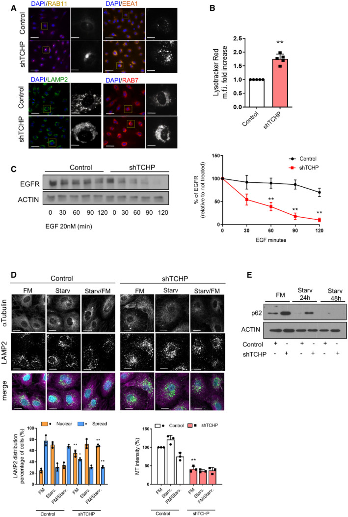 PMC7332983 – embr201948192-fig-0004ev