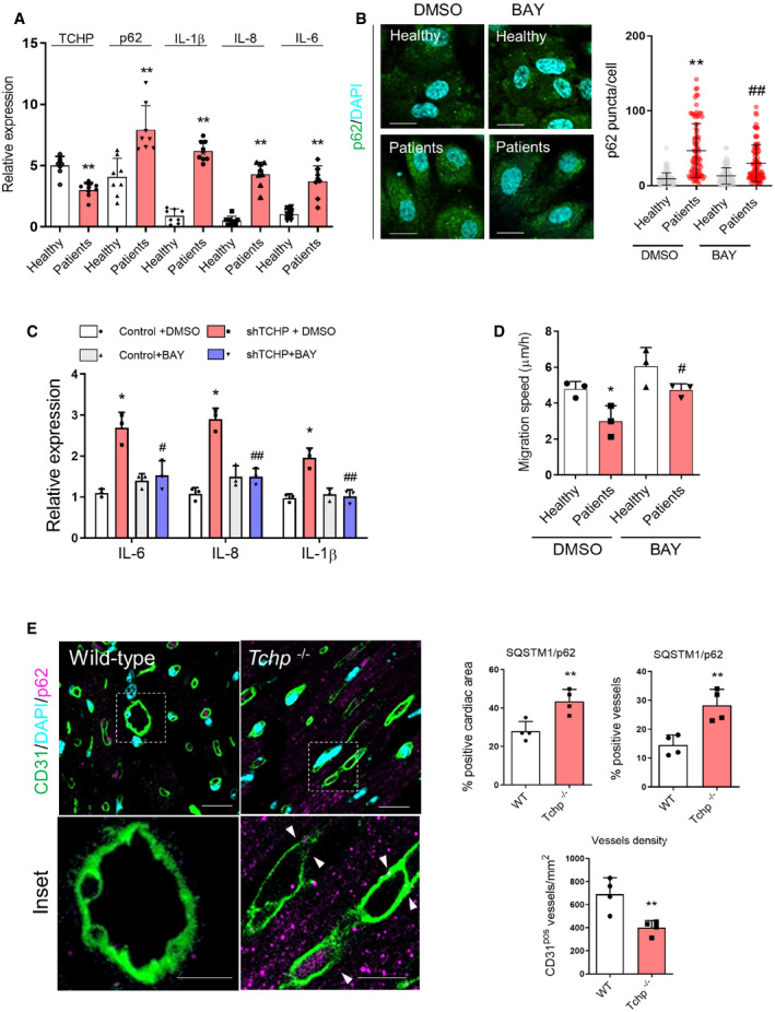 PMC7332983 – embr201948192-fig-0005