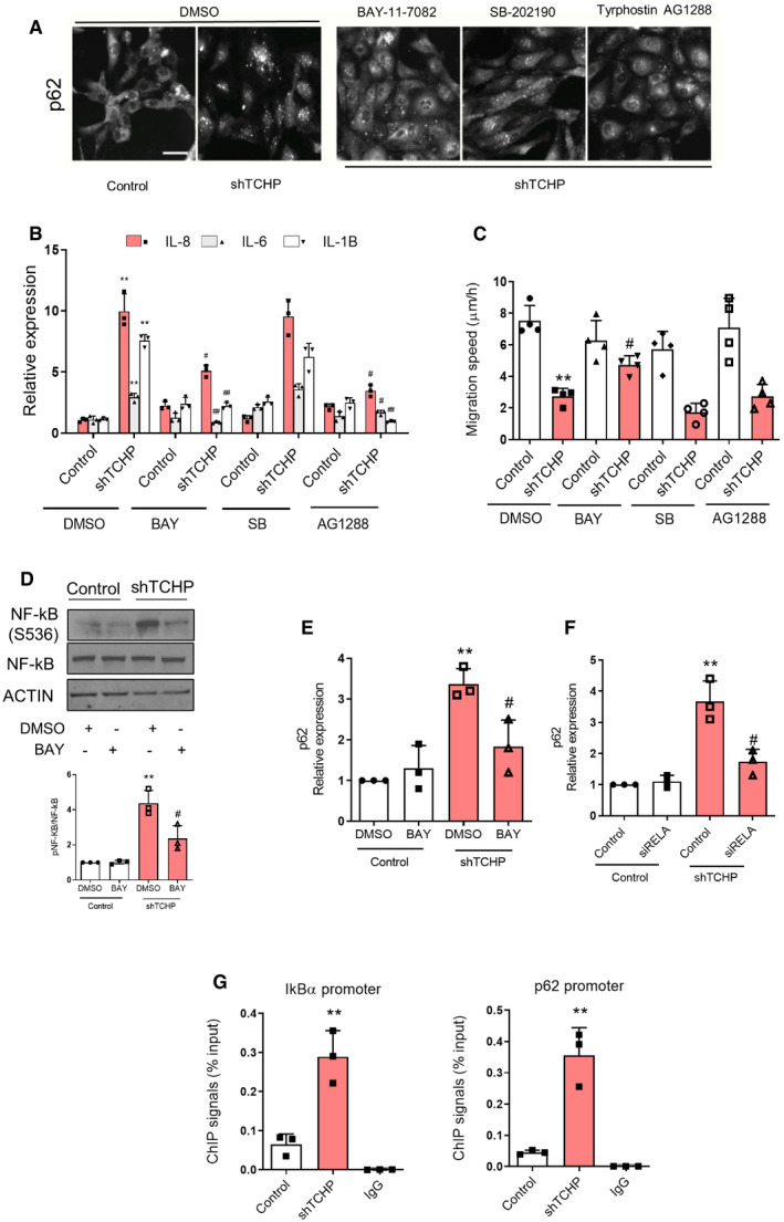 PMC7332983 – embr201948192-fig-0005ev