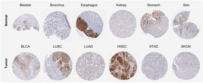 PMC10626275 – feb413698-fig-0004