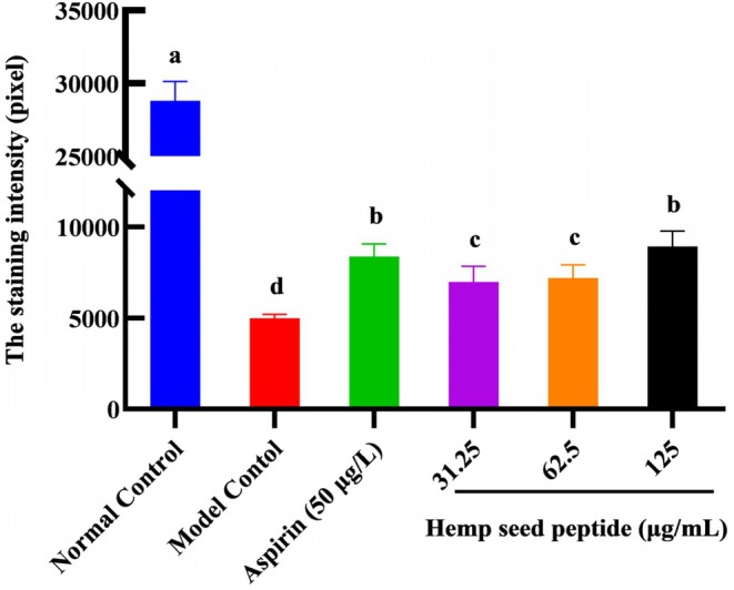 PMC12317113 – fsn370756-fig-0004