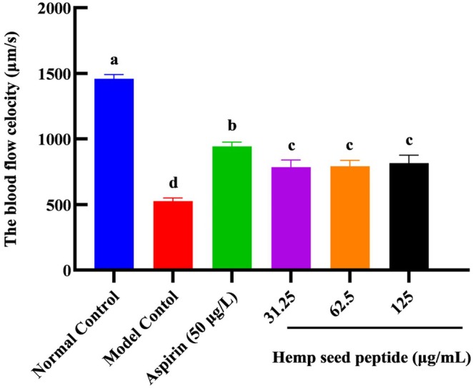 PMC12317113 – fsn370756-fig-0005