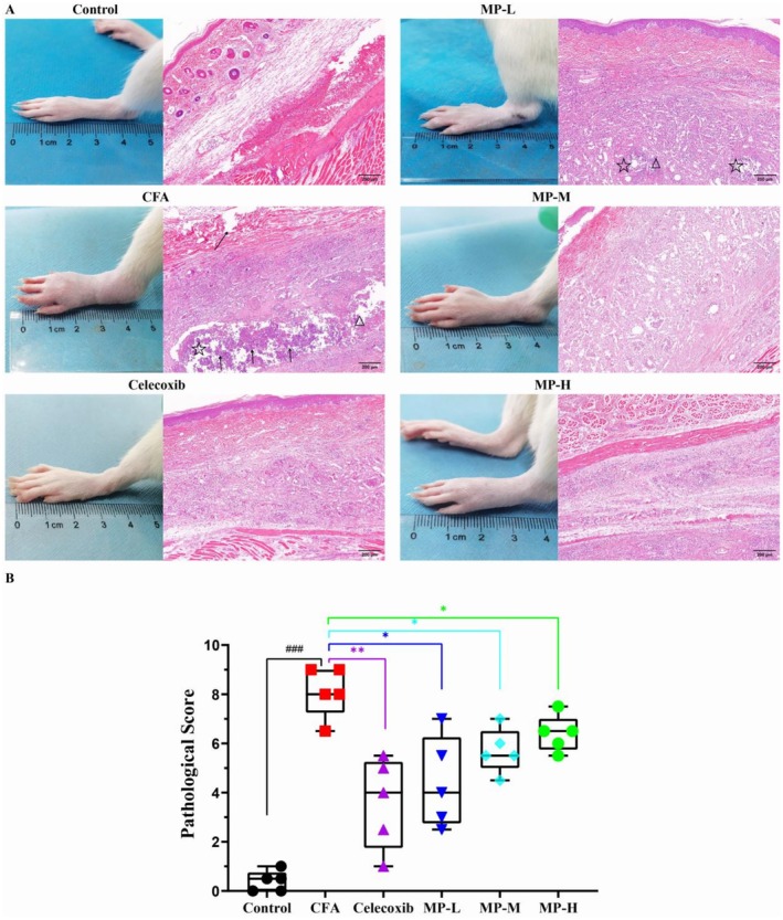 PMC13093352 – fsn371626-fig-0003