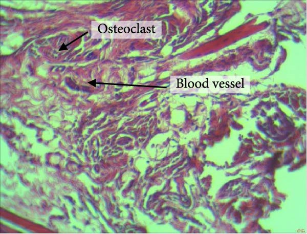 PMC12752900 – figpt-0012