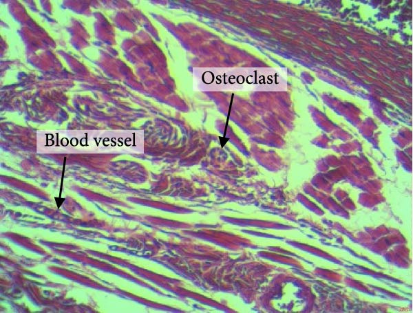 PMC12752900 – figpt-0011