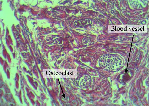 PMC12752900 – figpt-0010