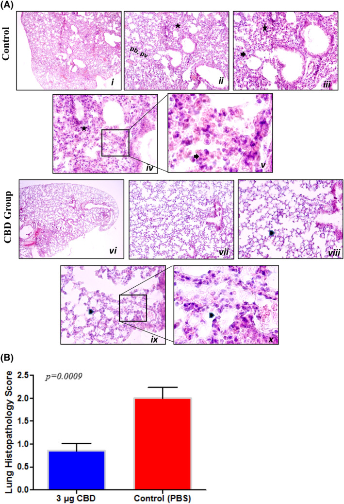 PMC11392655 – jcmm70030-fig-0003