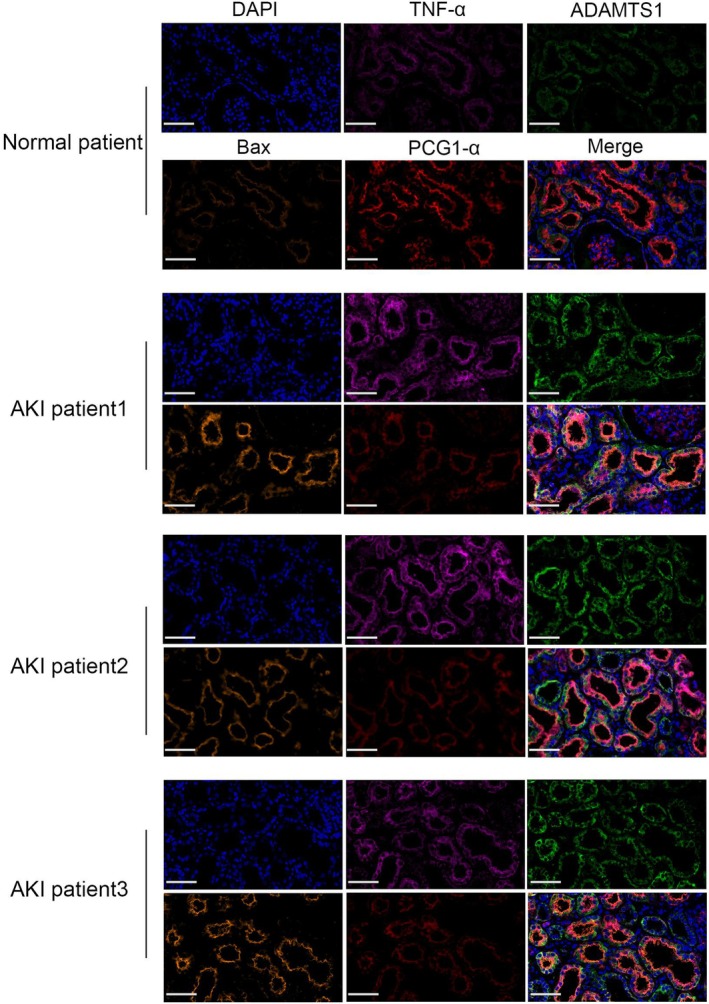 PMC12385122 – jcmm70801-fig-0010