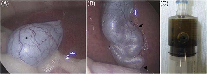 PMC8295664 – jvim16196-fig-0007