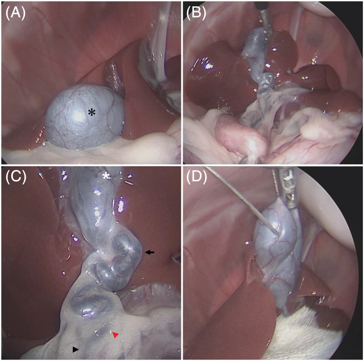 PMC8295664 – jvim16196-fig-0001