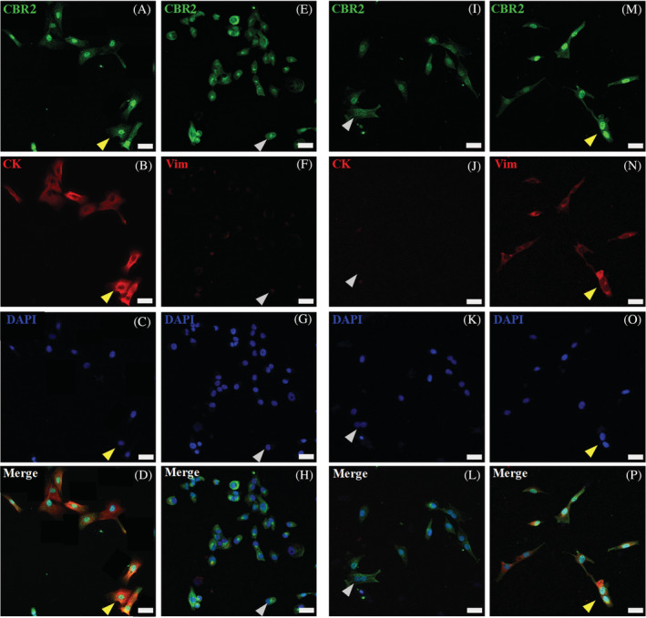 PMC9308437 – jvim16467-fig-0008