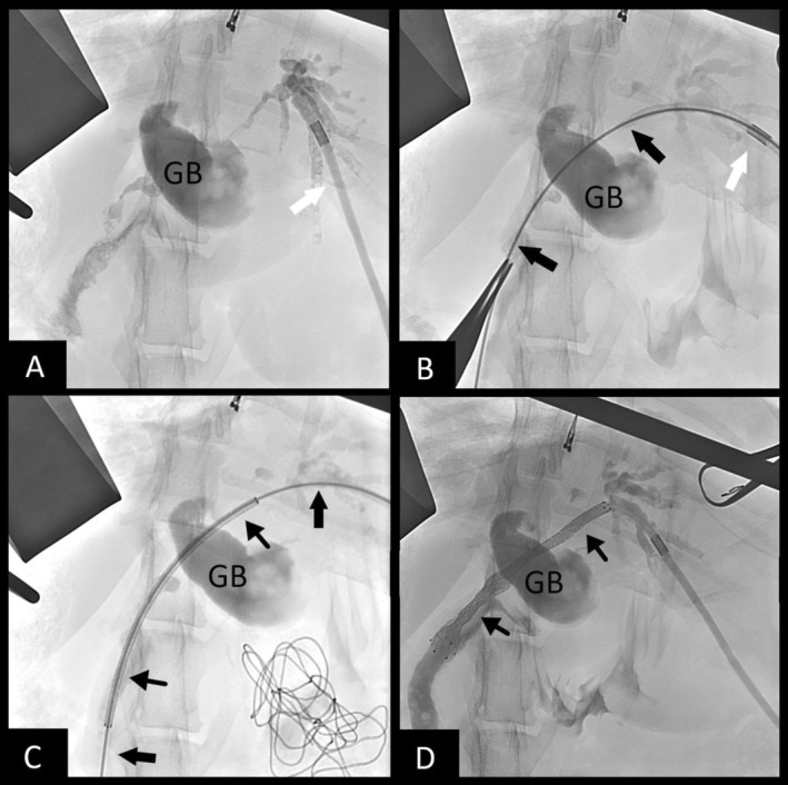 PMC12231240 – jvim70178-fig-0001