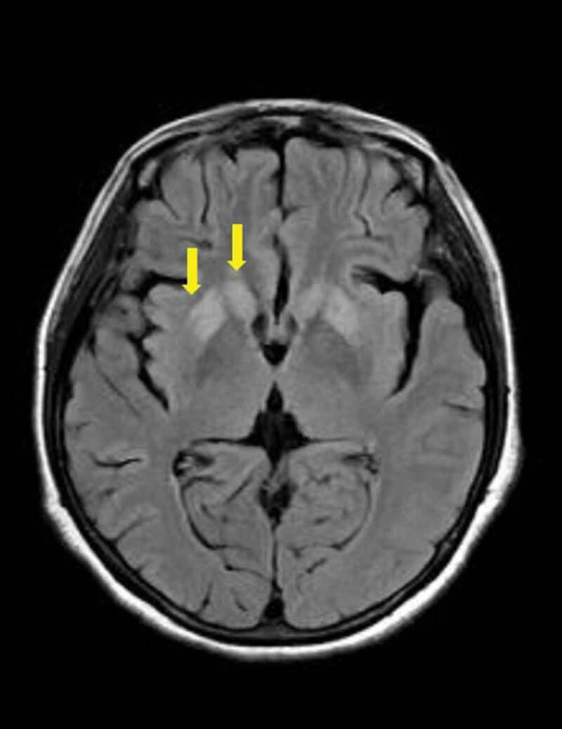 PMC7518738 – f0004