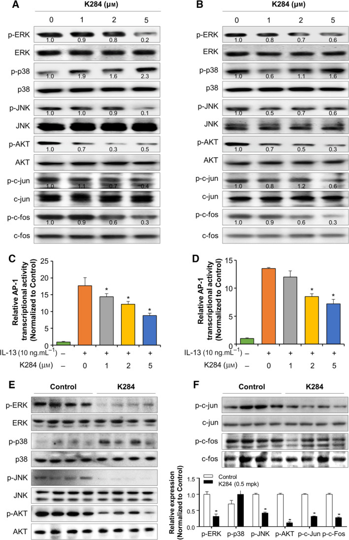 PMC8763653 – mol213138-fig-0006