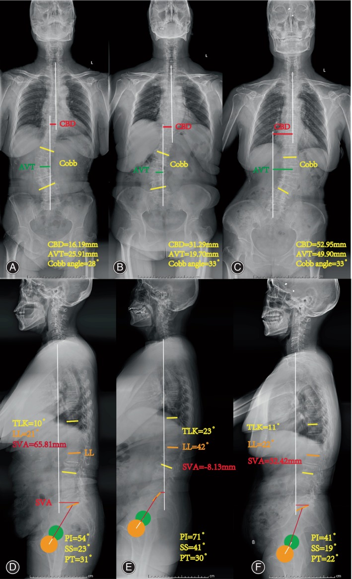 PMC11541118 – os14185-fig-0001