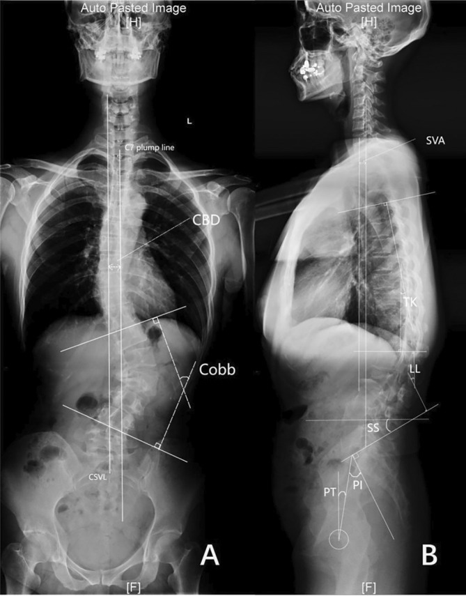 PMC12146131 – os70038-fig-0001