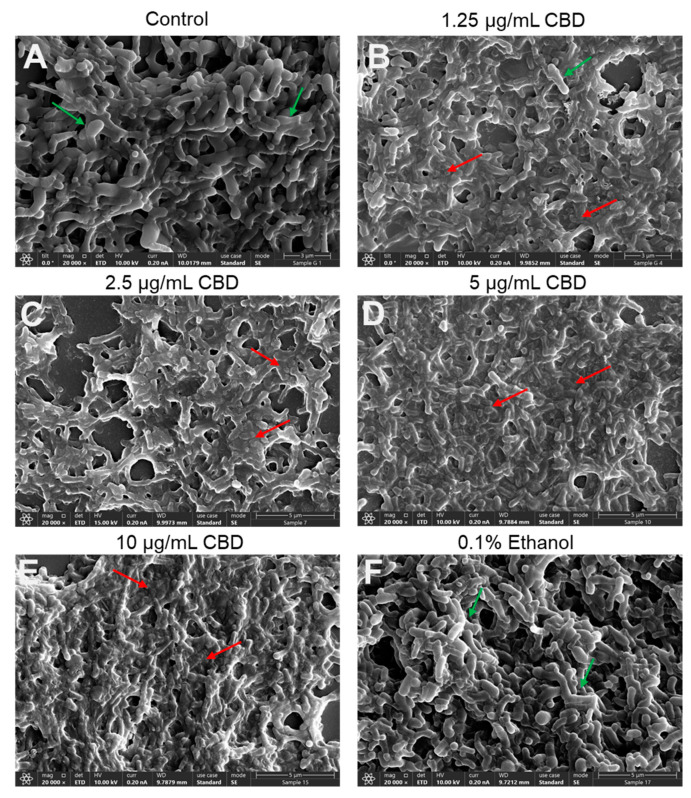 PMC11851883 – antibiotics-14-00136-f004