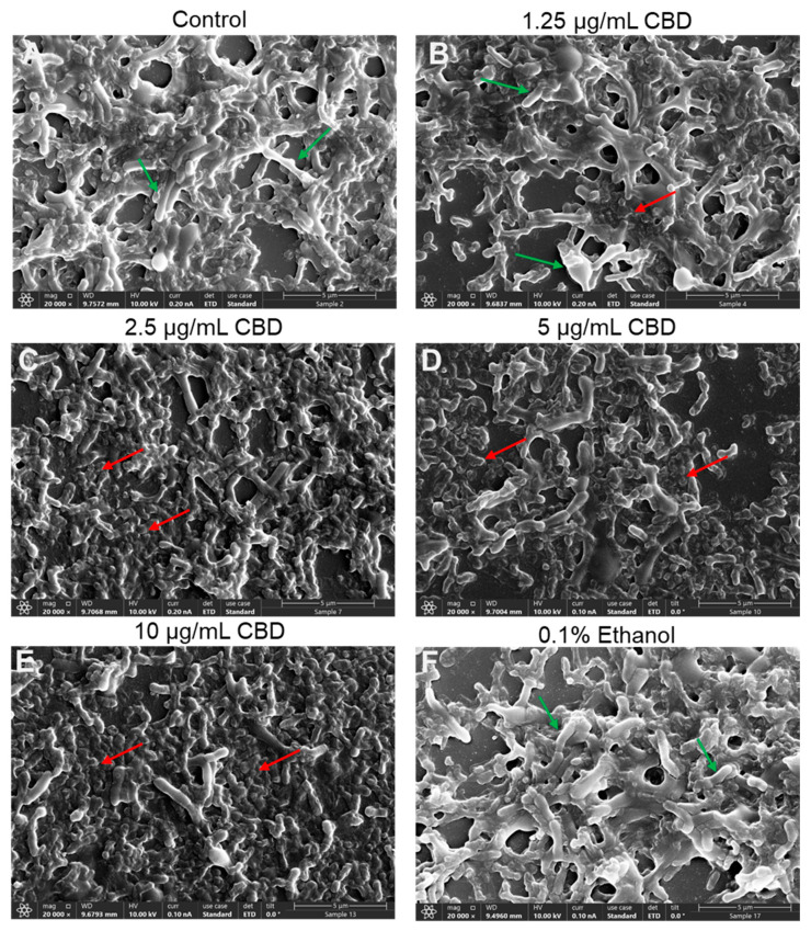 PMC11851883 – antibiotics-14-00136-f008