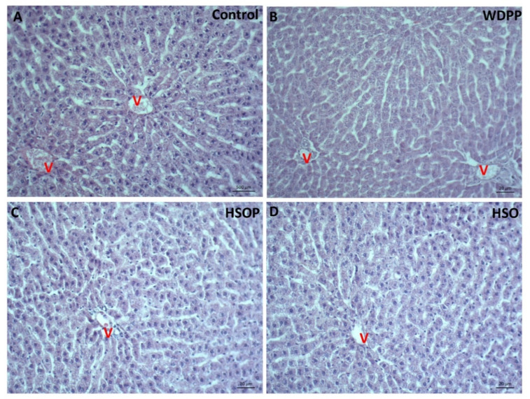 PMC7692817 – antioxidants-09-01066-f004