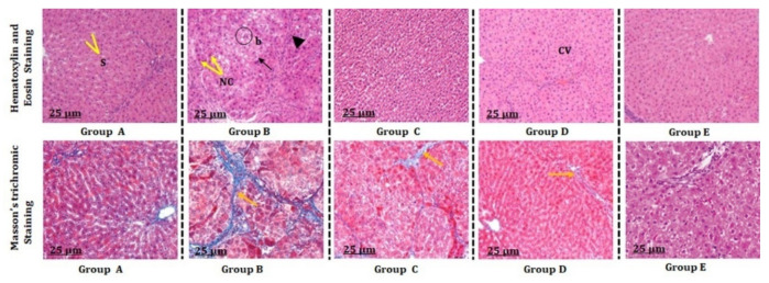 PMC9496017 – antioxidants-11-01824-f003