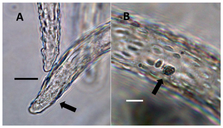 PMC9220352 – biology-11-00876-f004