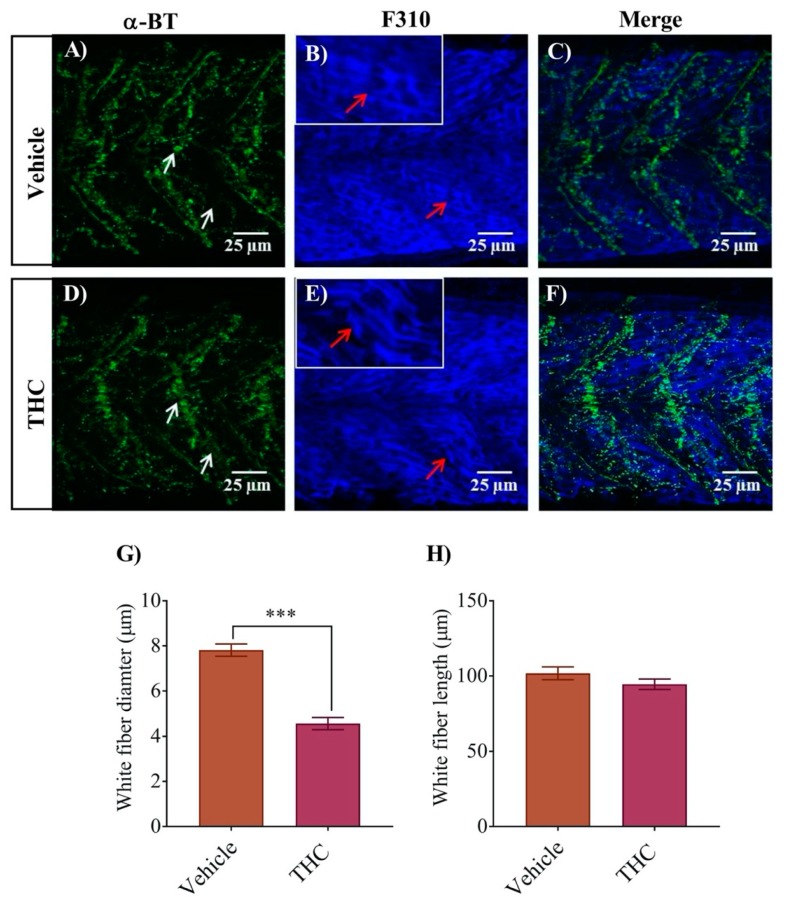 PMC7168183 – biomedicines-08-00005-f004