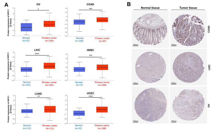 PMC8945479 – biomedicines-10-00637-f003