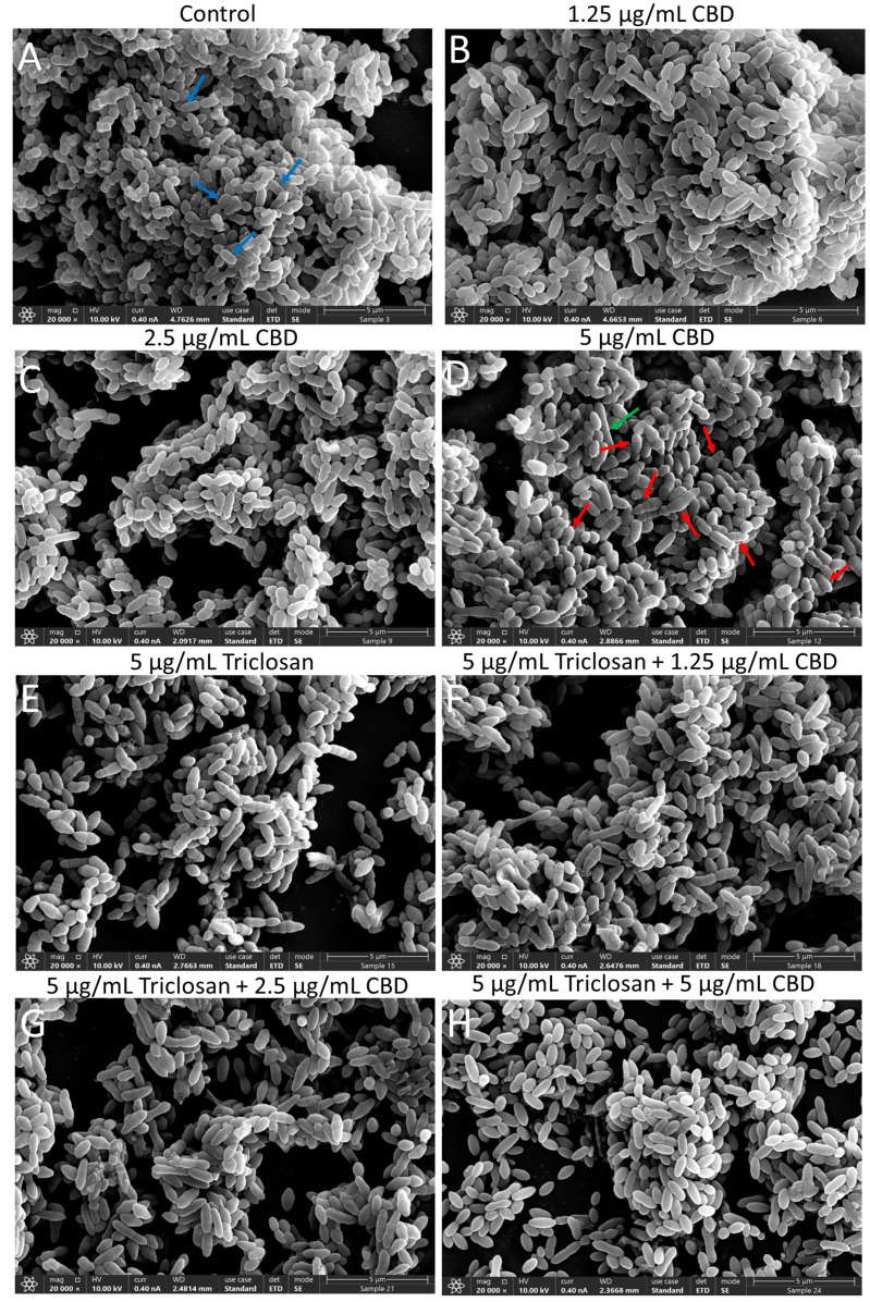 PMC9953046 – biomedicines-11-00521-f006