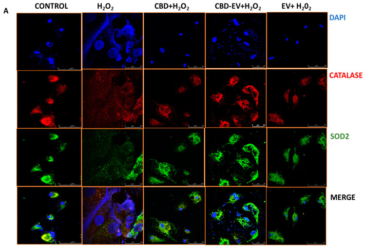 PMC12108686 – biomedicines-13-01167-f005