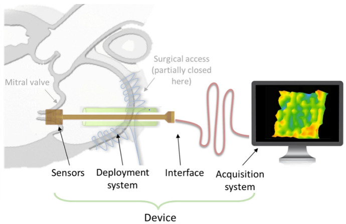 PMC9029272 – biosensors-12-00245-f014