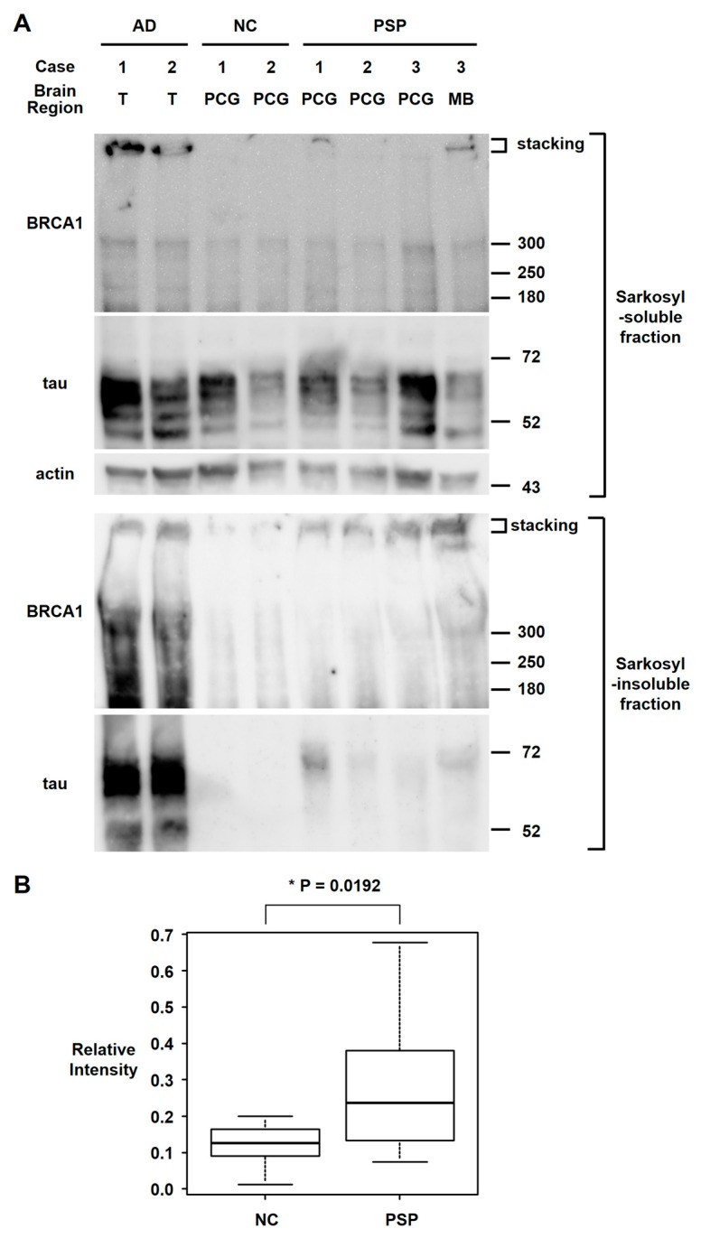 PMC7016802 – brainsci-10-00007-f004