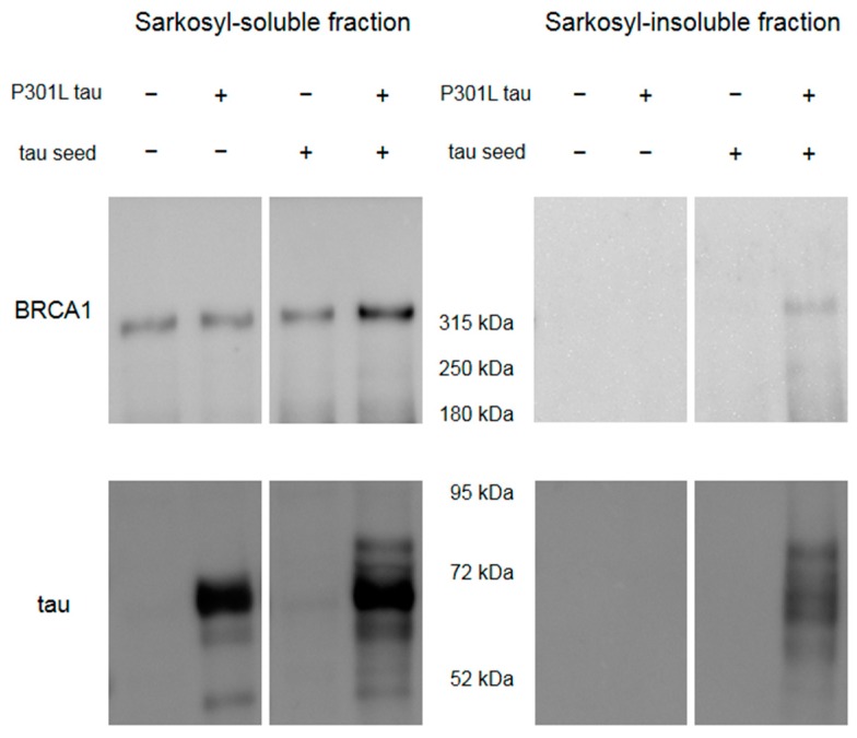 PMC7016802 – brainsci-10-00007-f005