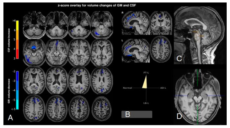 PMC7349831 – brainsci-10-00399-f002