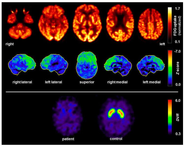 PMC7349831 – brainsci-10-00399-f003
